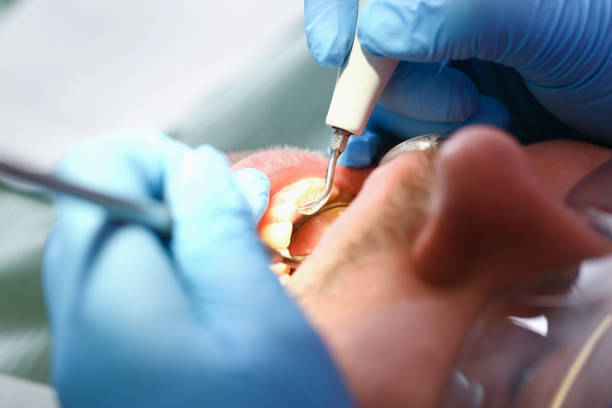 Best Pediatric Emergency Dentist in Pelican Bay, TX